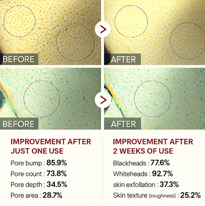 Elixiqa Peel Shot Glow Rice Ampoule