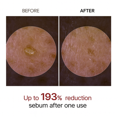 Elixiqa Peel Shot Glow Rice Ampoule